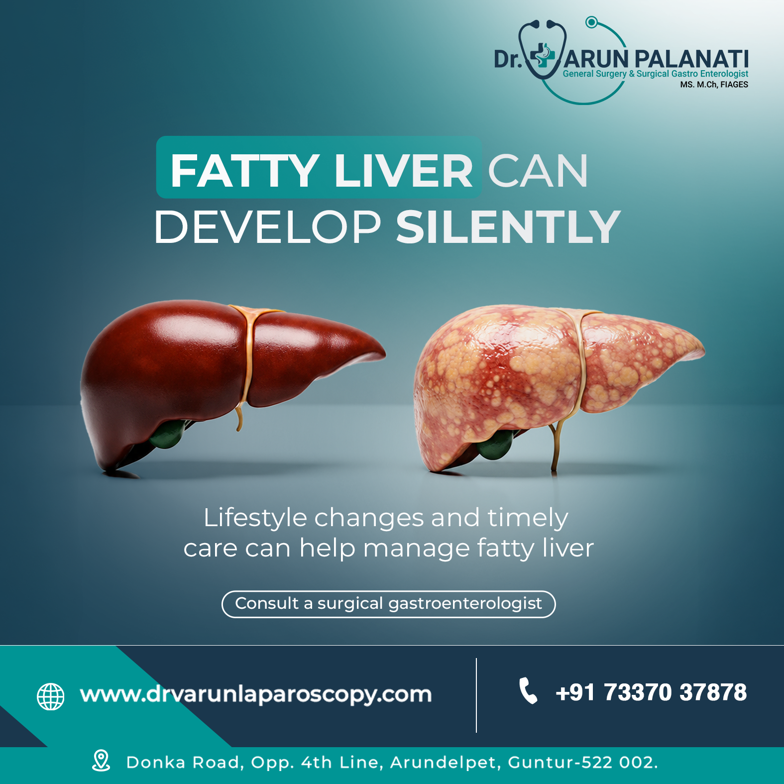 Dr. Varun Palanati Surgical Gastroenterology Digital Campaign